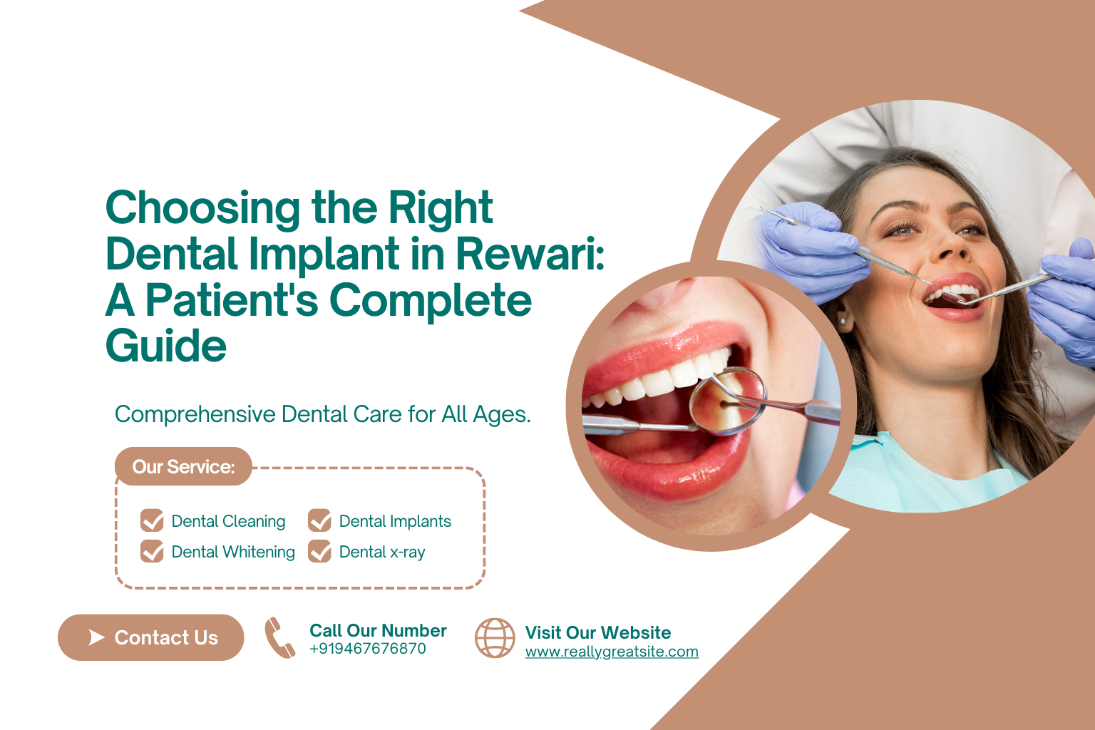 dental implant
