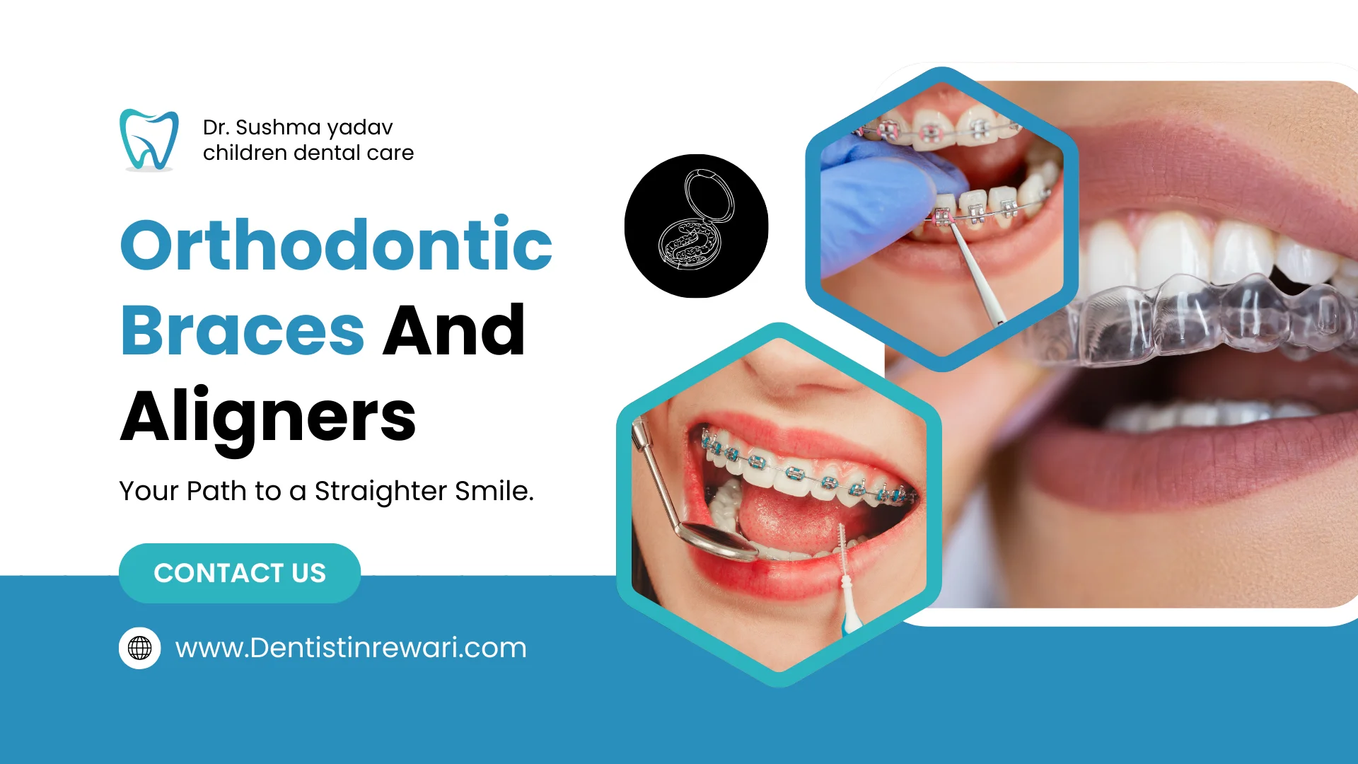 Braces & Orthodontic Treatment