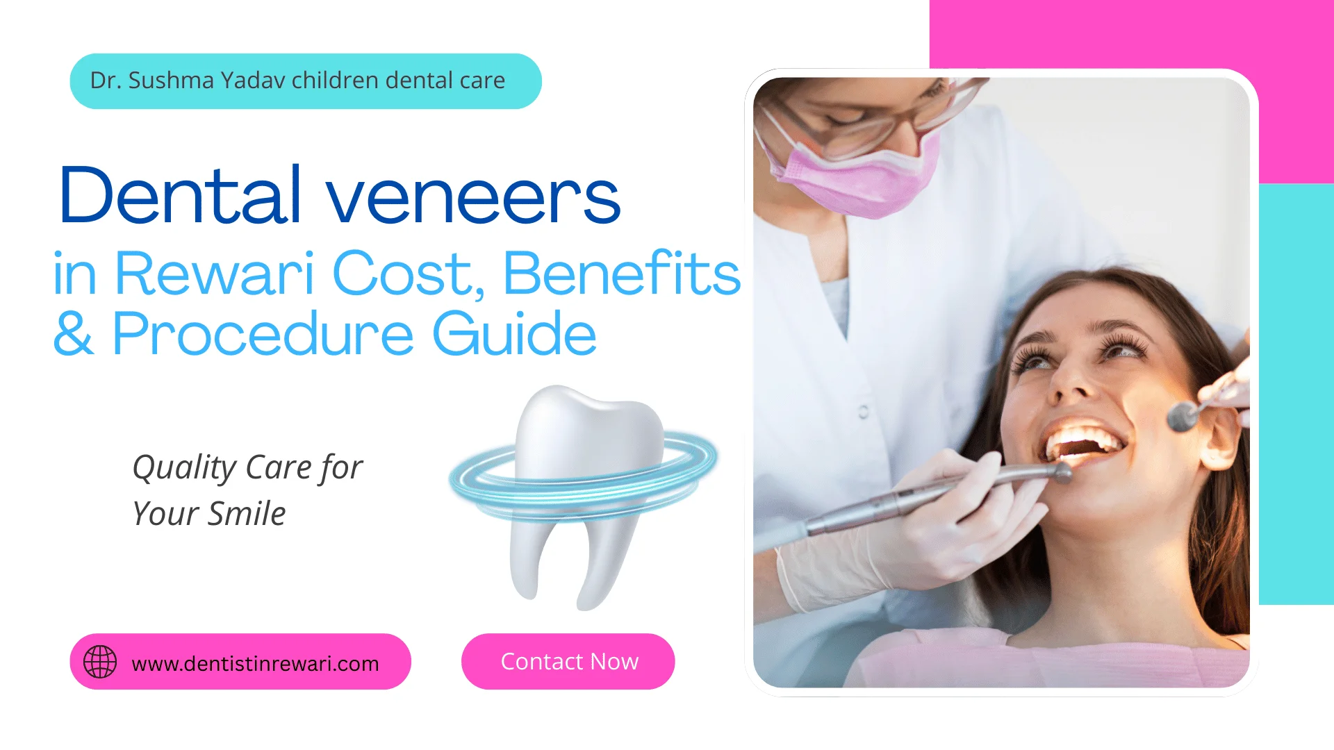 Dental Veneers