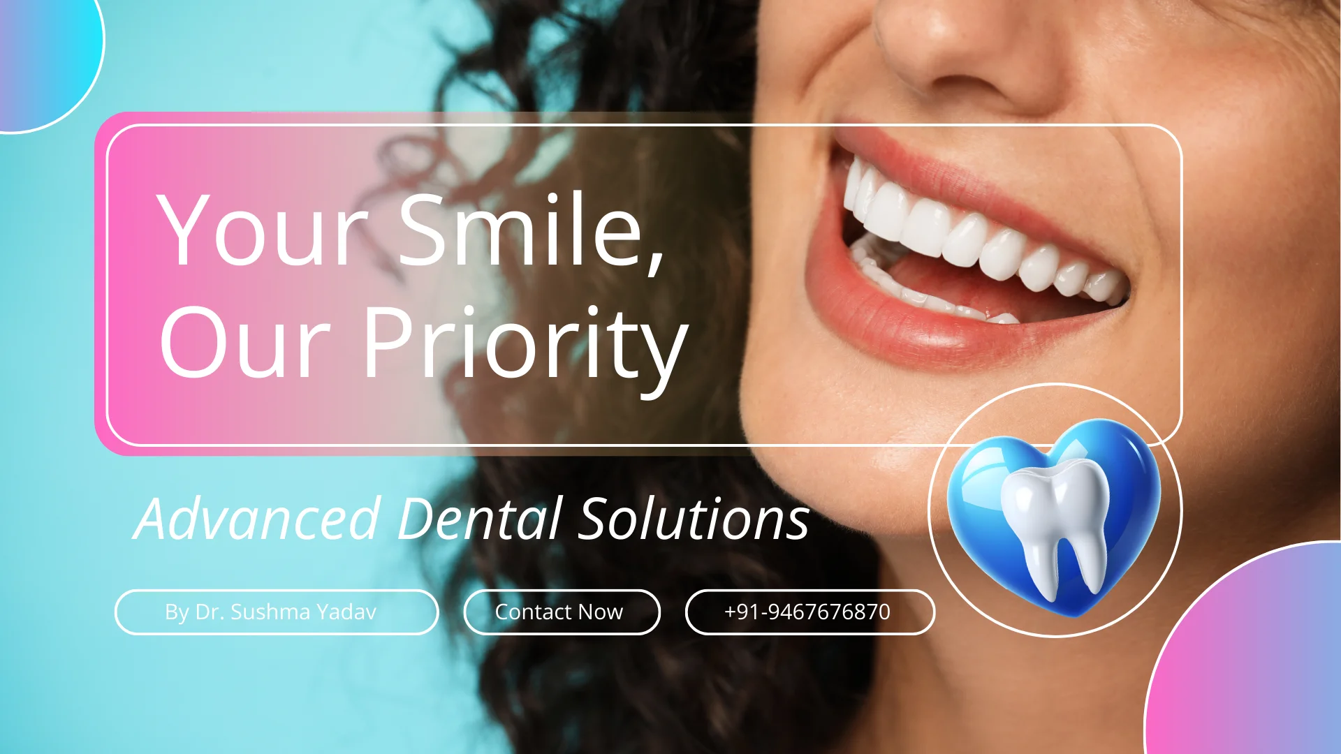 Dental Veneers