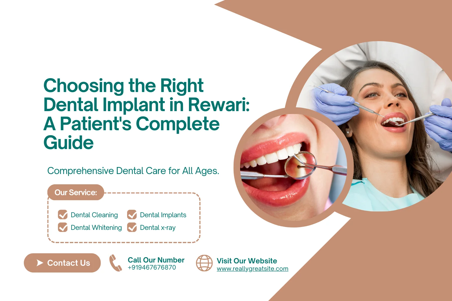 dental implant
